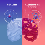 Understanding-Memory-Loss-Alzheimers-disease-the-basics.jpg